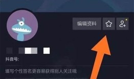抖音卡密获取指南：如何安全高效地获取抖音卡密?